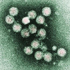 Hepatitis C Virus